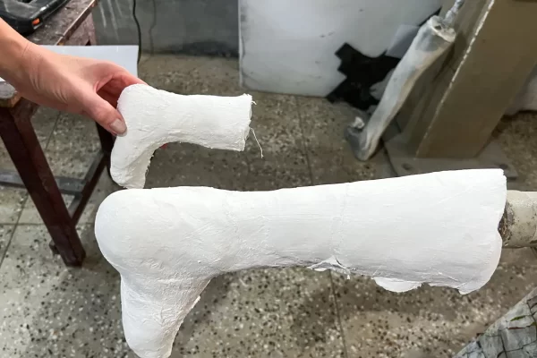 Abdruck für einen Gips im Spital der Lepra-Mission in Purulia.