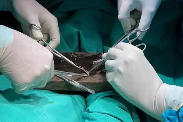 Haut-Transplantation im Spital der Lepra-Mission in Purulia.